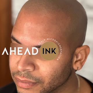 Scalp Micropigmentation at Ahead Ink North Bergen New Jersey