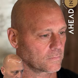 🖼️ Your face is the picture. Your hairline is the frame.

Think about a great painting or a beautif