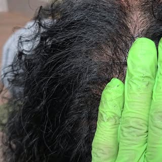 Nashville's #1 Scalp Micropigmentation Technician! Who said women can't get SMP? Get  your confidenc