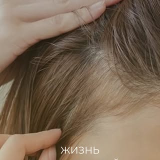 Ежедневно человек теряет до 100 волос — и это считается нормой.

👨‍🦲 Но если волос становится заме