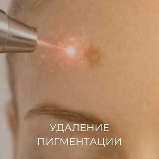 Для удаление пигментации обращайтесь в наш центр! 🤍

- - - - - - - - - - - - - - - - - -

Записатьс