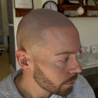 Nyt look med en smuk og naturlig hårgrænse ✨
Denne transformation er taget i naturligt lys for at fr
