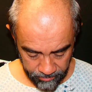 Capillus Robotics - Hair Restoration Center

Agenda HOY MISMO tu CITA de Valoración GRATUITA León, G