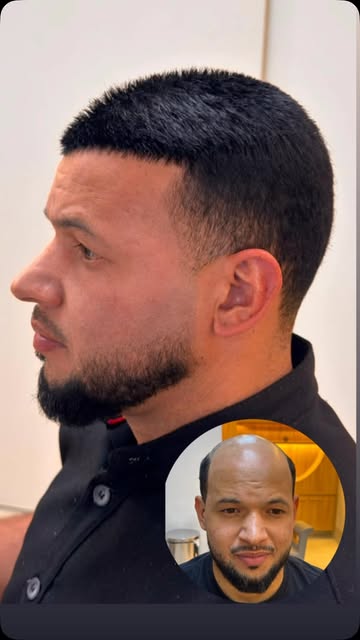 Cabelo baixinho?
Temos!