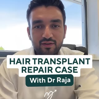 Dr. Raja breaks down a recent case study.

After an unsatisfactory hair transplant in Turkey, this p