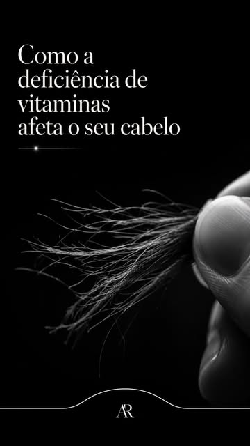 Tireoide: tanto hipotireoidismo quanto hipertireoidismo alteram o ciclo capilar e podem causar queda