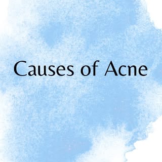 Causes of Acne..!!! 
.
.
.
.
#causesofacne #acne #acnetreatment #acnescar #antiacne #acnescars #acne