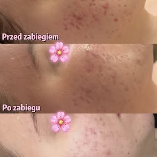 To nie jest Prima Aprilis 🐰🌸

Wprowadziłam do gabinetu nowości, które przypadną do gustu szczególn
