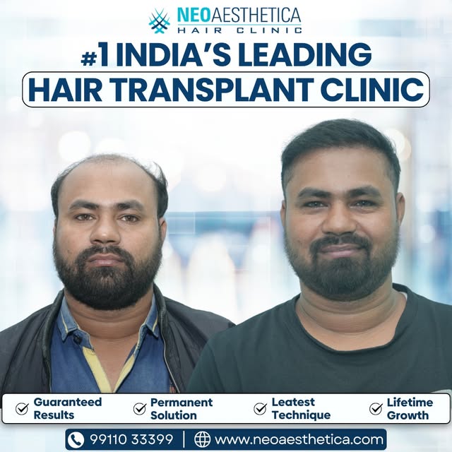 Advanced restoration for a hairline that feels truly yours.

Tags: natural looking hair, hair growth