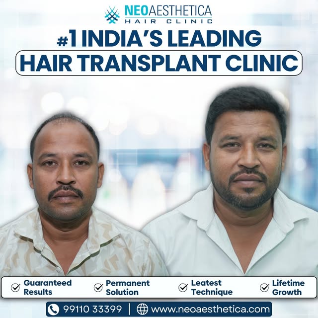 Hair restoration designed to match your natural growth pattern.

Tags: natural looking hair, hair gr