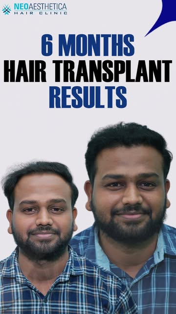 Expert-led hair restoration for results that feel effortless.

Tags: natural looking hair, hair grow