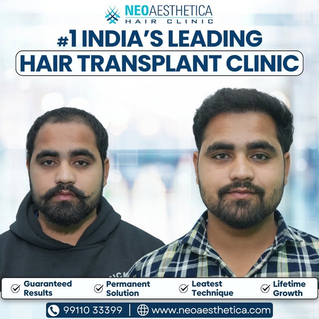 Thoughtfully planned hair restoration for a more balanced appearance.

Tags: natural looking hair, h