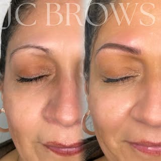 Before: rounded thin eyebrows
After: Nano + powder style and provided client with a lifted arch for 