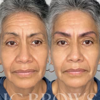 New brows providing an illusion of a facelift while improving symmetry✨

DM for free online / in per