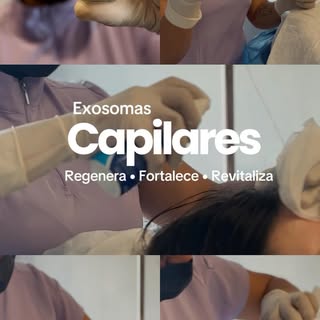 Exosomas Capilares
✨ Fortalece tu cabello con Exosomas Capilares

Los exosomas capilares apoyan los 