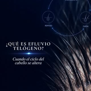 ¿Notas que estás perdiendo más cabello de lo habitual?

El efluvio telógeno es un tipo de caída capi