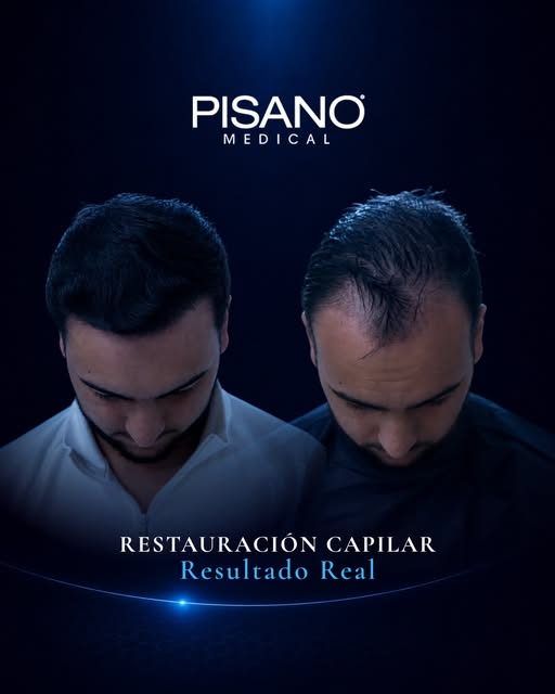 Cada caso comienza en un punto diferente.

En esta evolución, el cambio se aprecia especialmente en 