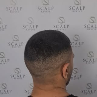 Magic hands 🙌🏾 #scalp #micro #pigmentation #hairloss #hairtattoo #hair #haircut #hairstyle #style 