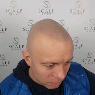 SMP - Scalp Revive