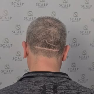 Scar camouflage @scalprevive 😎👏🏽👏🏽