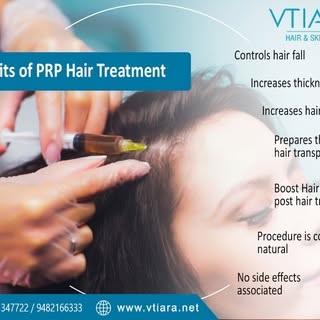 PRP (platelet-rich plasma) therapy for hair loss is a three-step medical treatment in which a person
