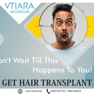 Vtiara is one of the outstanding hair transplantation clinics in Bangalore with a team of exceptiona