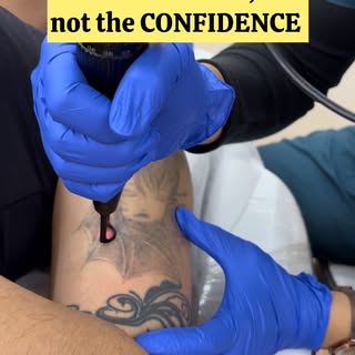 Nothing is permanent,
Not even your tattoo 😉
.
.
.
#lasertattooremoval #lasertreatments #drskinsane