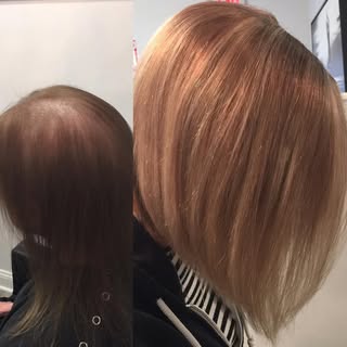 Human hair volumiser can be easily attached to a thinning hair