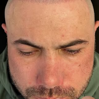Scalp micropigmentation is the only guaranteed hair loss solution.

At Scalp Styles UK, we offer a r