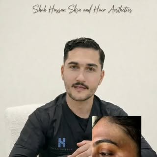 Let your skin tell story of rejuvenation
www.shahhassanch.com
#pigmentation #darkspots #melasma #lah
