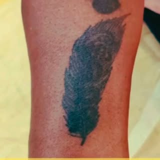 Erase the ink. Restore your confidence ✨
Experience advanced Laser Tattoo Removal with expert care a