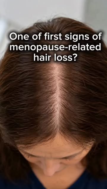 A widening part can be one of the most noticeable signs of hair thinning during menopause.

As hormo