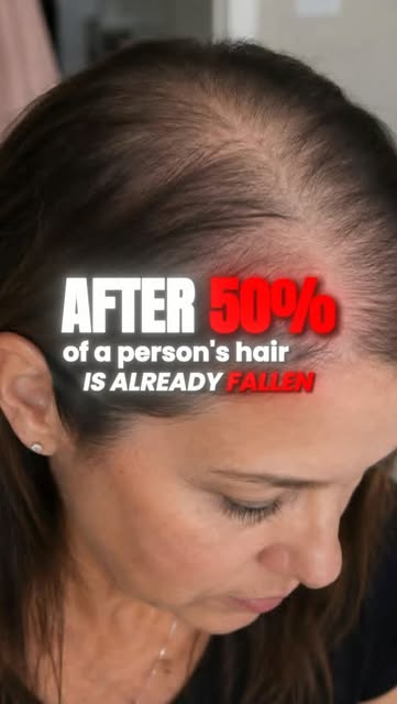 Hair loss can have many different causes — and the right treatment starts with understanding what’s 