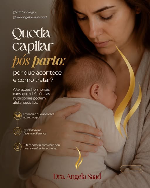 A queda de cabelo no pós-parto é comum, mas merece atenção.

Após o nascimento do bebê, é natural qu