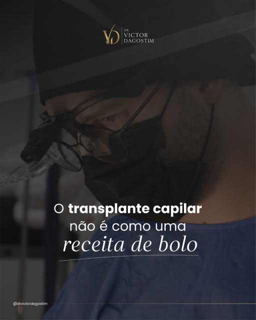 O transplante capilar exige planejamento individualizado.

Extensão da calvície, características da 