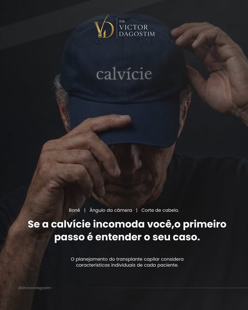 A queda de cabelo pode ter diferentes causas.

Por isso, utilizar shampoos, vitaminas, séruns ou out
