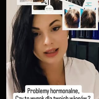 💥Hormony kontra włosy? Nie wszystko stracone!💥

Cierpisz na problemy hormonalne i widzisz to na sw