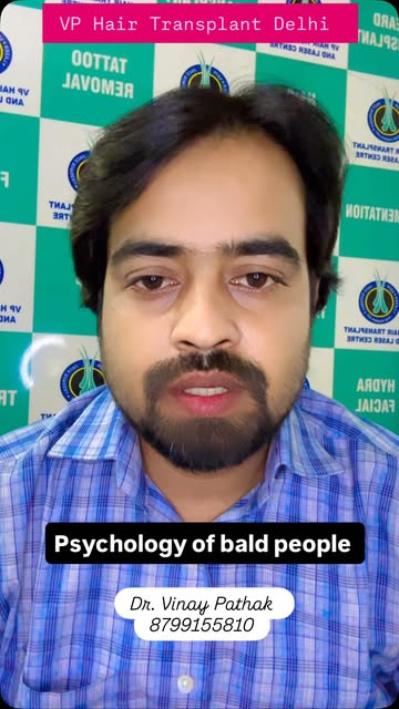 Psychology of Bald people #bald #hairtreatment #hairtransplant #viral