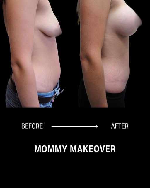 Motherhood changes your body, but it doesn't have to define how you feel about it.

Pregnancy and br