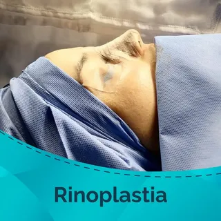 Descubre la armonía: Rinoplastia para una elegancia Equilibrada.🌺

#cirugia #cirujanos #cirugiaplas
