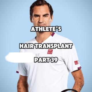 Athletes Hair Transplants Part 39
.
.
Roger Federer hair transplant 🎾
.
.
#rogerfederer #tennis #te