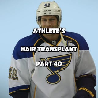 Athletes Hair Transplants Part 40
.
.
David Backes hair transplant 🏒⛸️
.
.
#davidbackes #nhl #iceho