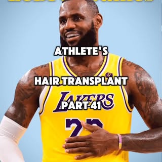 Athlete's Hair Transplant - Part 41
.
.
LeBron James 🏀
.
.
#lebronjames #nba #athleteshairtransplan