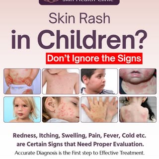 Skin rash in children? Don’t ignore the signs ⚠️
Redness, itching, swelling or fever can indicate un