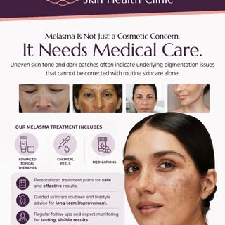 Melasma is more than just a cosmetic concern ✨
Uneven skin tone and dark patches need expert medical