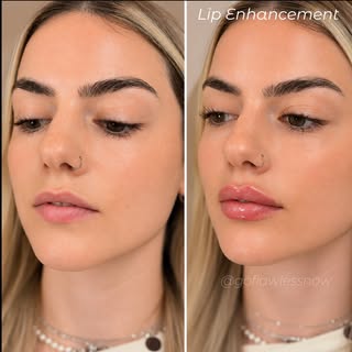 The biggest mistake people make when shopping for aesthetic treatments? Asking for the price before 