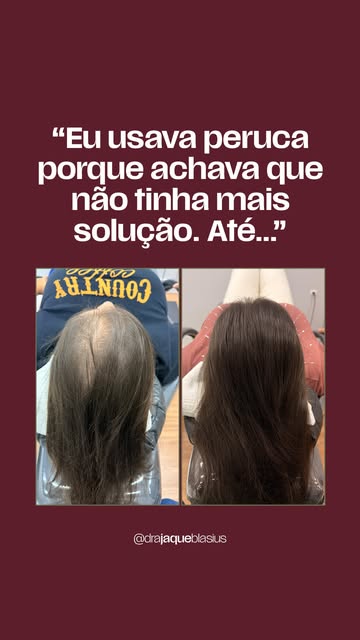 Quando a Ivanete chegou até mim, não era só o cabelo que estava incomodando.

Ela já tinha mudado a 