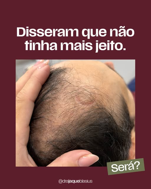 Ele chegou até mim depois de ouvir que não tinha mais o que fazer pelo cabelo.

Mas antes de dar o d