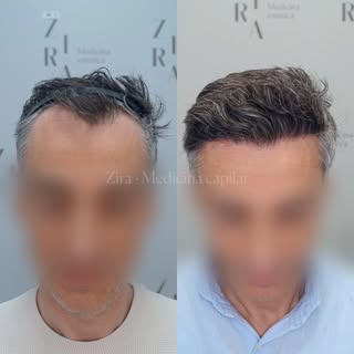 ✨Uno de mis tipos de pelo favoritos para trabajar: el pelo canoso✨

Llevaba tiempo sin compartir res