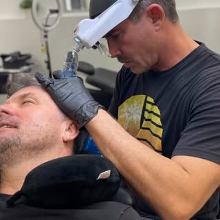 Hair density fill with scalp micro pigmentation- client today. For thinning hair ..

#smp #la #santa